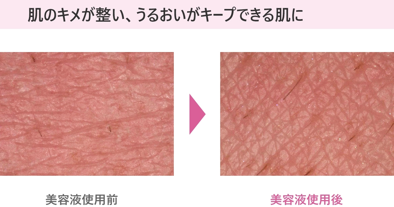 イチジク美容液　使用前・使用後